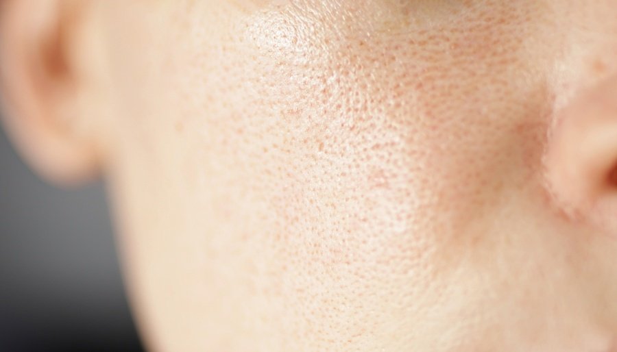 Open pore skin